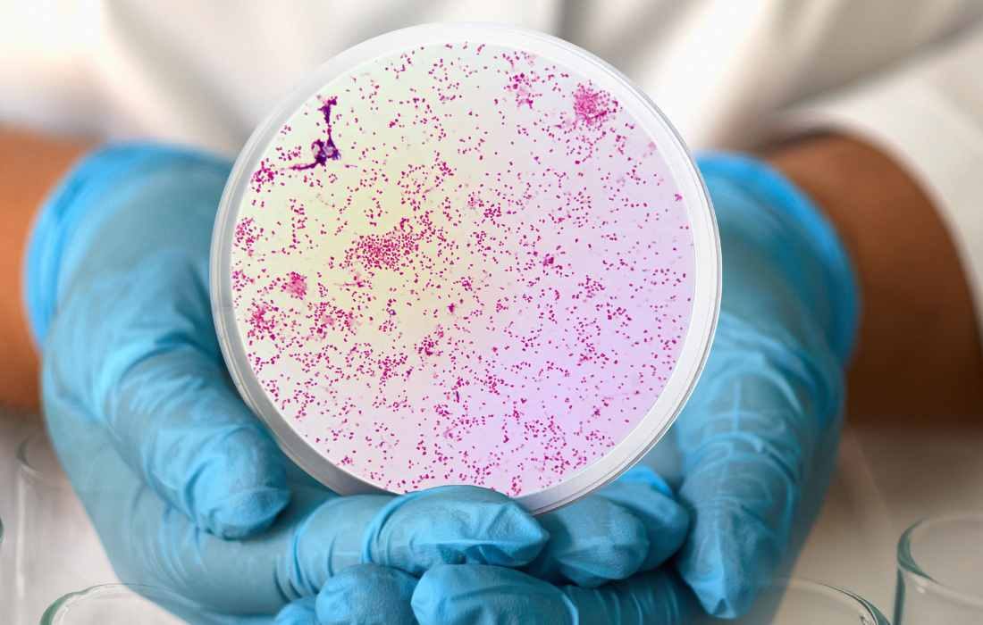 CARB-X funds development of rapid test for gonorrhea